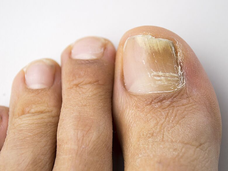 Početna faza gljive